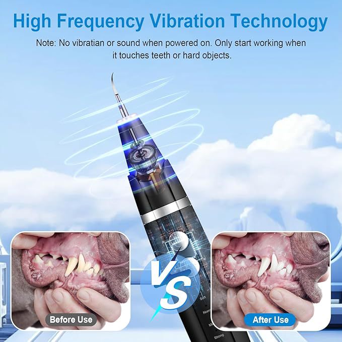 High-frequency vibration technology illustration for plaque removal