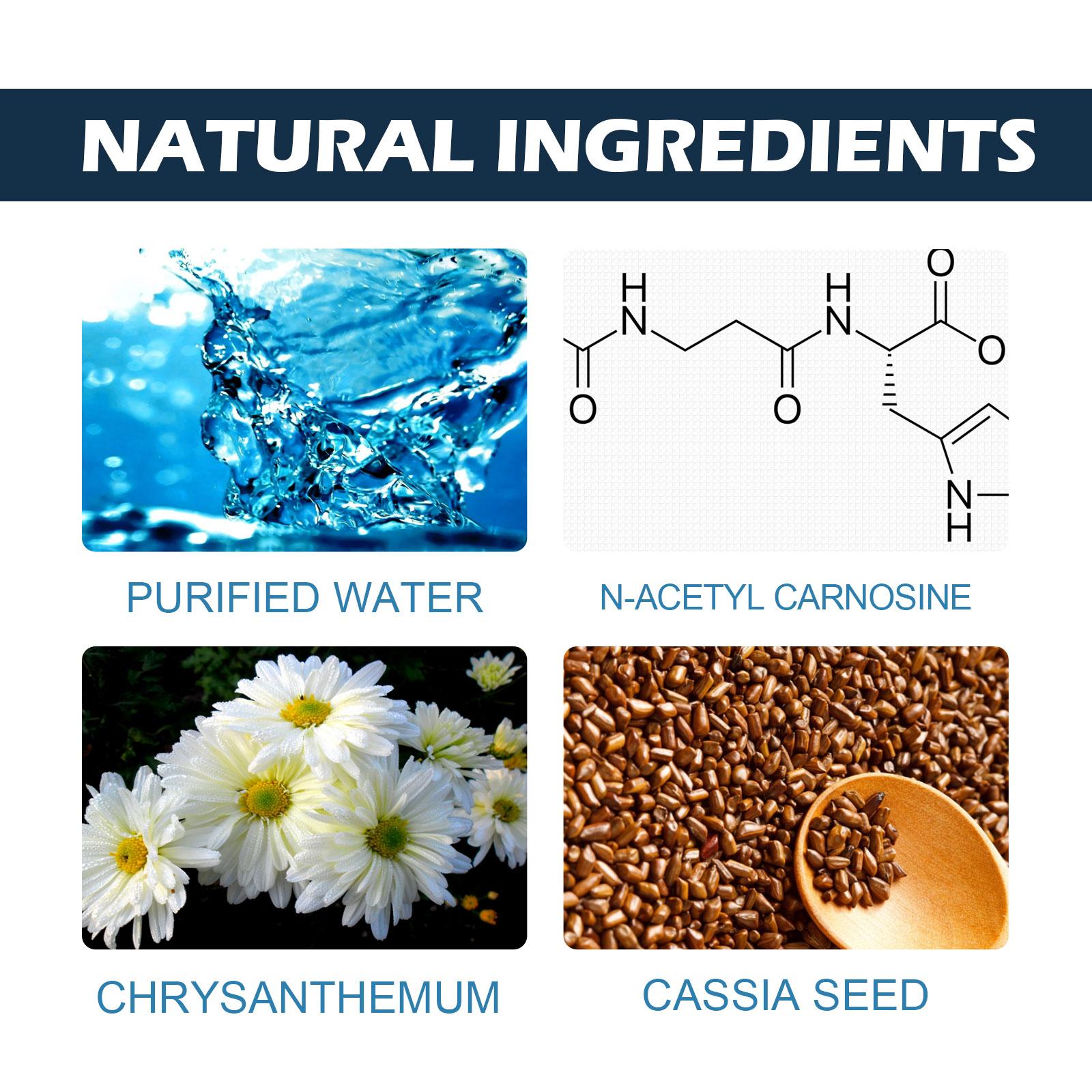 Cat eye cleaning with gentle pet eye drops